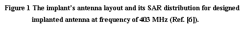 eLXg {bNX: Figure 1 The implantfs antenna layout and its SAR distribution for designed implanted antenna at frequency of 403 MHz (Ref. [6]).


